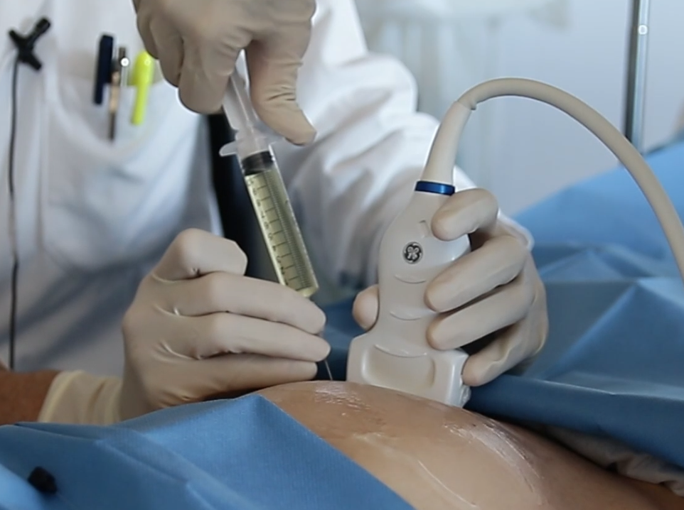 AmnioSIM: Técnicas invasivas en diagnóstico prenatal
